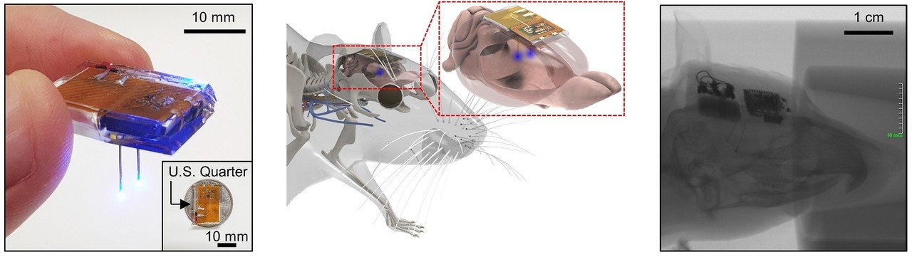 정재웅 교수 연구팀이 개발한 뇌 이식용 무선 디바이스(사진=카이스트)
